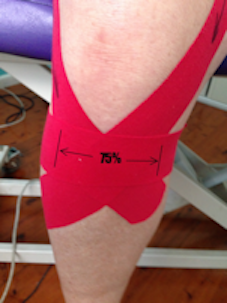 Knee strapping
